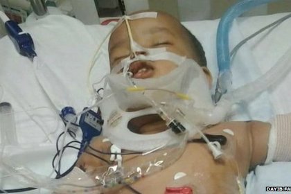 Годовалый ребенок упал в США с 11 этажа и выжил