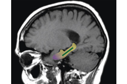 Какао оказалось мощным средством против старческого слабоумия