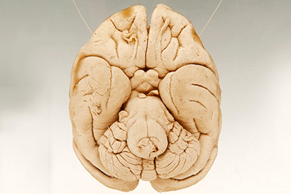 Найдена отвечающая за уникальность человеческого разума зона мозга