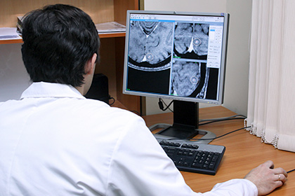 Низкую физическую активность связали с уменьшением объема головного мозга