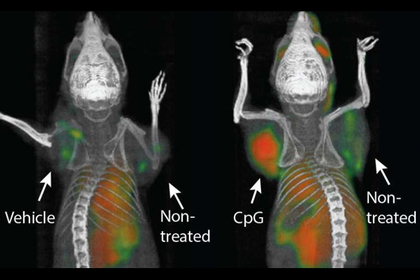 Ученые побороли неизлечимый рак