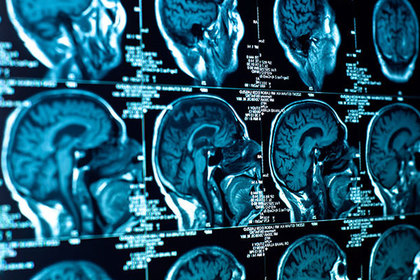 У финансово успешных людей обнаружена физиологическая особенность