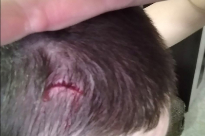 Noize MC разбил голову фанату на концерте и раскритиковал его за жалобы