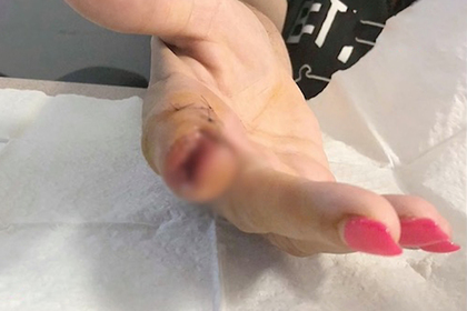 Девушка посетила маникюрный салон и лишилась фаланги пальца