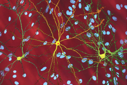 Найдено средство против смертельных заболеваний мозга