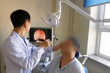 Ни о чем не подозревающий мужчина десятки лет жил с зубом в носу