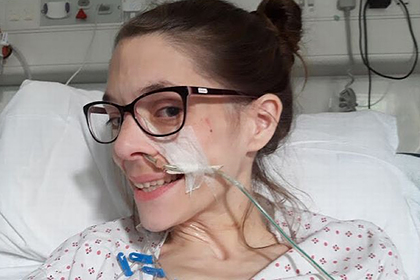 Женщина похудела до 35 килограммов из-за врожденной болезни