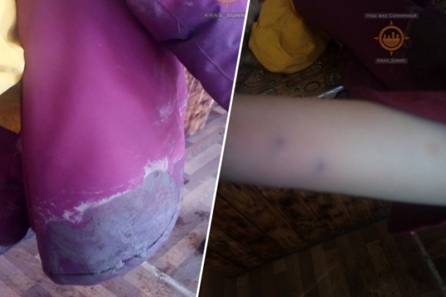 Бездомные собаки в «Солнечном» напали на ребенка около школы