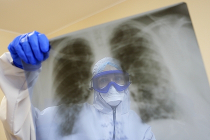 Врач описала течение болезни при повторном заражении коронавирусом