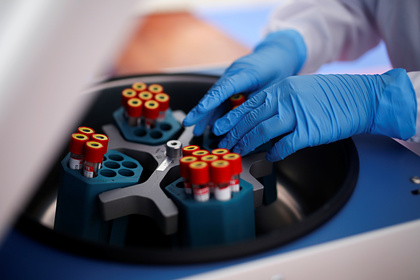 Российский врач назвал способ избежать тромбозов после коронавируса