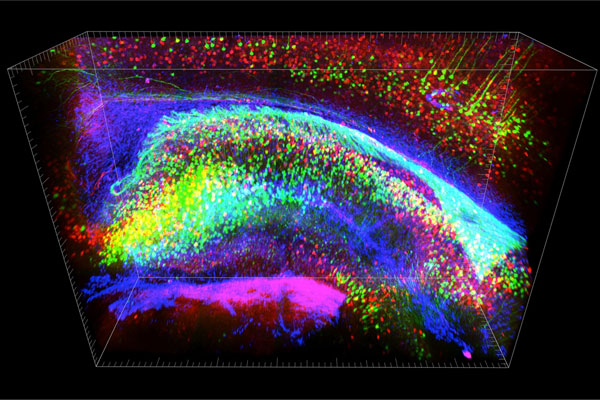 Ученые сделали мозг прозрачным при помощи сахарного сиропа