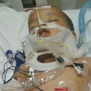 Годовалый ребенок упал в США с 11 этажа и выжил