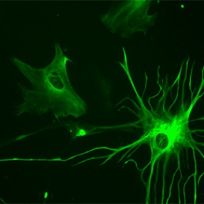 Пересадка клеток из мозга человека изменила умственные способности мышей