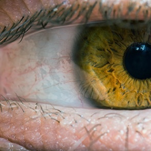 Зоркость людей объяснили устройством черепа