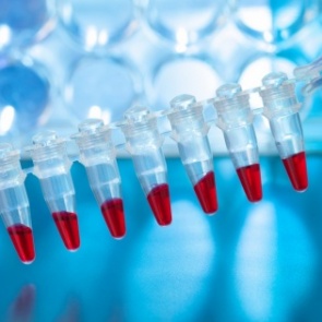 Допинг мельдоний обнаружен у красноярских регбистов «Енисей-СТМ»