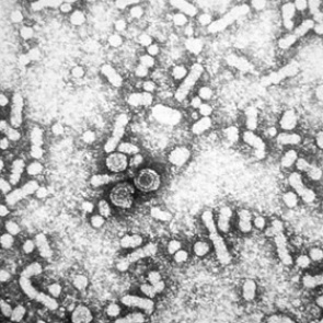 Гепатит признали главной угрозой человечеству