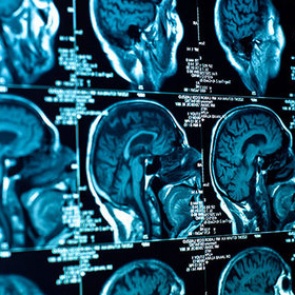 У финансово успешных людей обнаружена физиологическая особенность