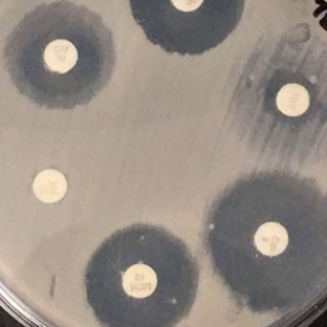 Названа неожиданная опасность уборки пыли