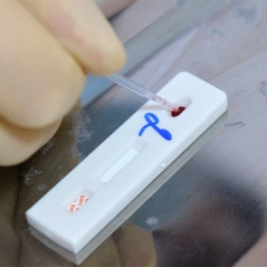 В России стали реже выявлять ВИЧ