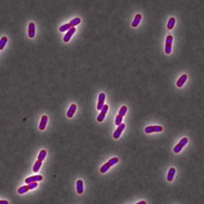 Названа опасность популярных бытовых товаров
