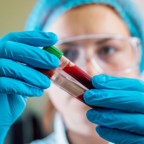 Анализ крови на гормоны