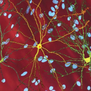 Найдено средство против смертельных заболеваний мозга