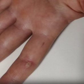 «Поставил велосипед и закричал»: ребёнка на улице ударило током