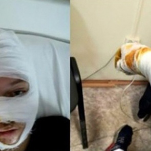 Запертые в полицейской машине российские подростки подожгли ее изнутри