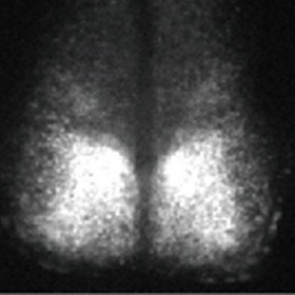 Мертвый мозг оживили на несколько недель