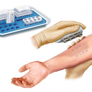 Аллергические пробы