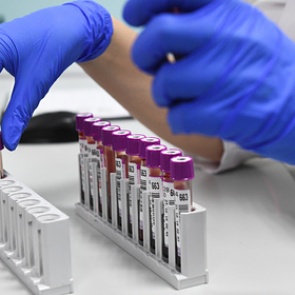 Россия получит доступ в созданные на деньги США биолаборатории