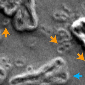 Раскрыта причина непобедимости рака