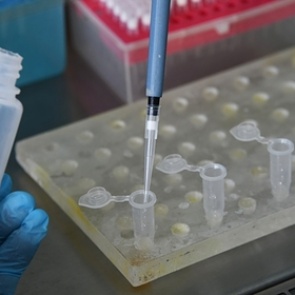 Ученые создали экспресс-тест на коронавирус