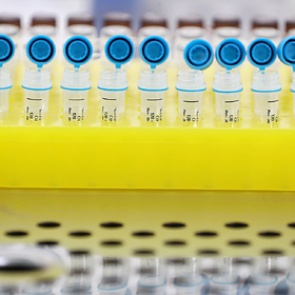 В России за сутки выявили свыше тысячи новых случаев заражения коронавирусом