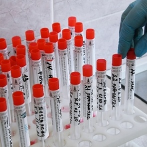 Найден подавляющий коронавирус за двое суток препарат