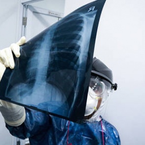 Опубликованы данные по заразившимся коронавирусом на утро 10 апреля