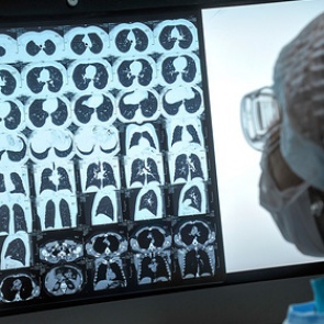 Кремль назвал сроки пика заражения коронавирусом в России