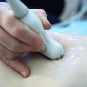 Женщин предупредили о возможном бесплодии из-за коронавируса