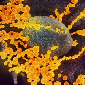 Названо уникальное свойство коронавируса