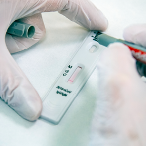 Собянин объявил о массовой проверке москвичей на иммунитет к коронавирусу