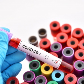 В Красноярском крае выявили еще 131 больного коронавирусом. Никто не умер