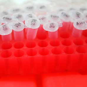 Российские фармкомпании призвали отложить регистрацию вакцины от коронавируса