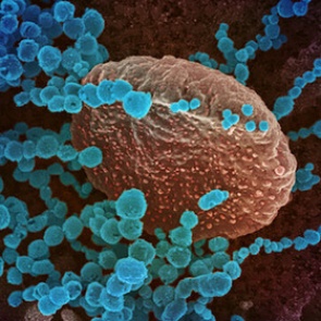 Раскрыты изменения в организме зараженного коронавирусом человека