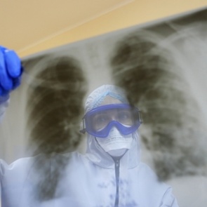 Врач описала течение болезни при повторном заражении коронавирусом