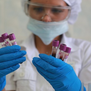 График приема анализов лабораторией Центра СПИД в нерабочие и праздничные дни