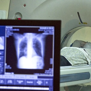 Врачи назвали способ без симптомов узнать о наступлении шести опасных видов рака