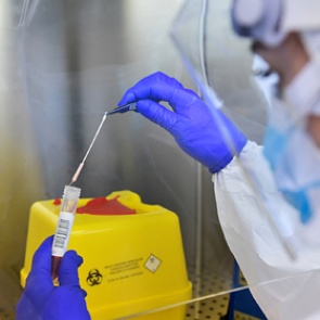 Эксперты ВОЗ отработали четыре версии передачи коронавируса человеку