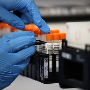 В США заявили об отсутствии доказательств лабораторного происхождения COVID-19