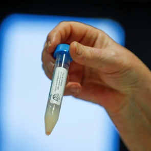 Россиянам назвали оптимальный уровень антител для ревакцинации