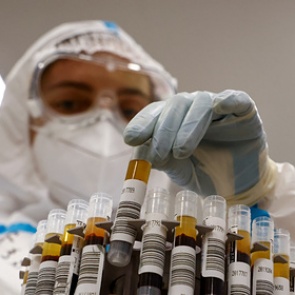 В России появится биочип для диагностики COVID-19